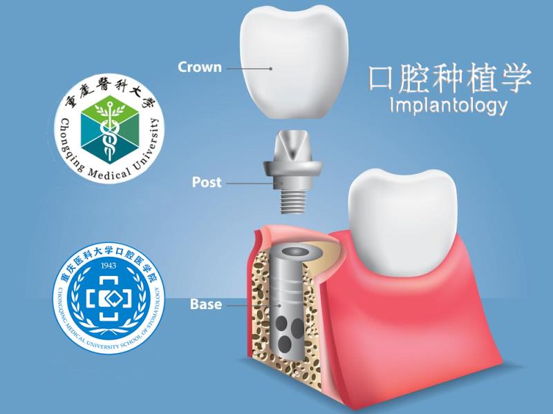 新品　新口腔病理学 牙科口腔教学模型：牙周病理模型，让你在家也能成为刮治高手